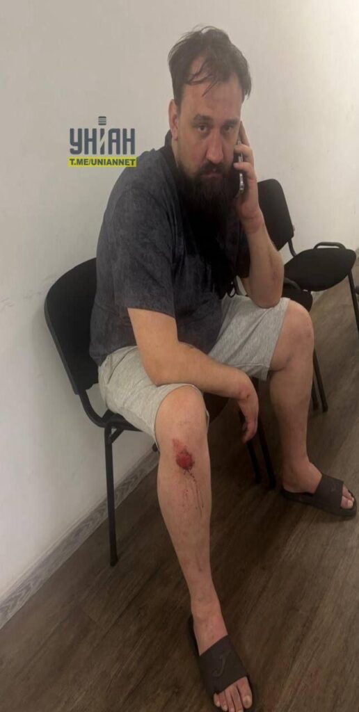 У Києві блогера та активіста Дениса Кошельника затримали після п'яної ДТП та спроби втечі від поліції 4 У Києві блогера та активіста Дениса Кошельника затримали після п'яної ДТП та спроби втечі від поліції
